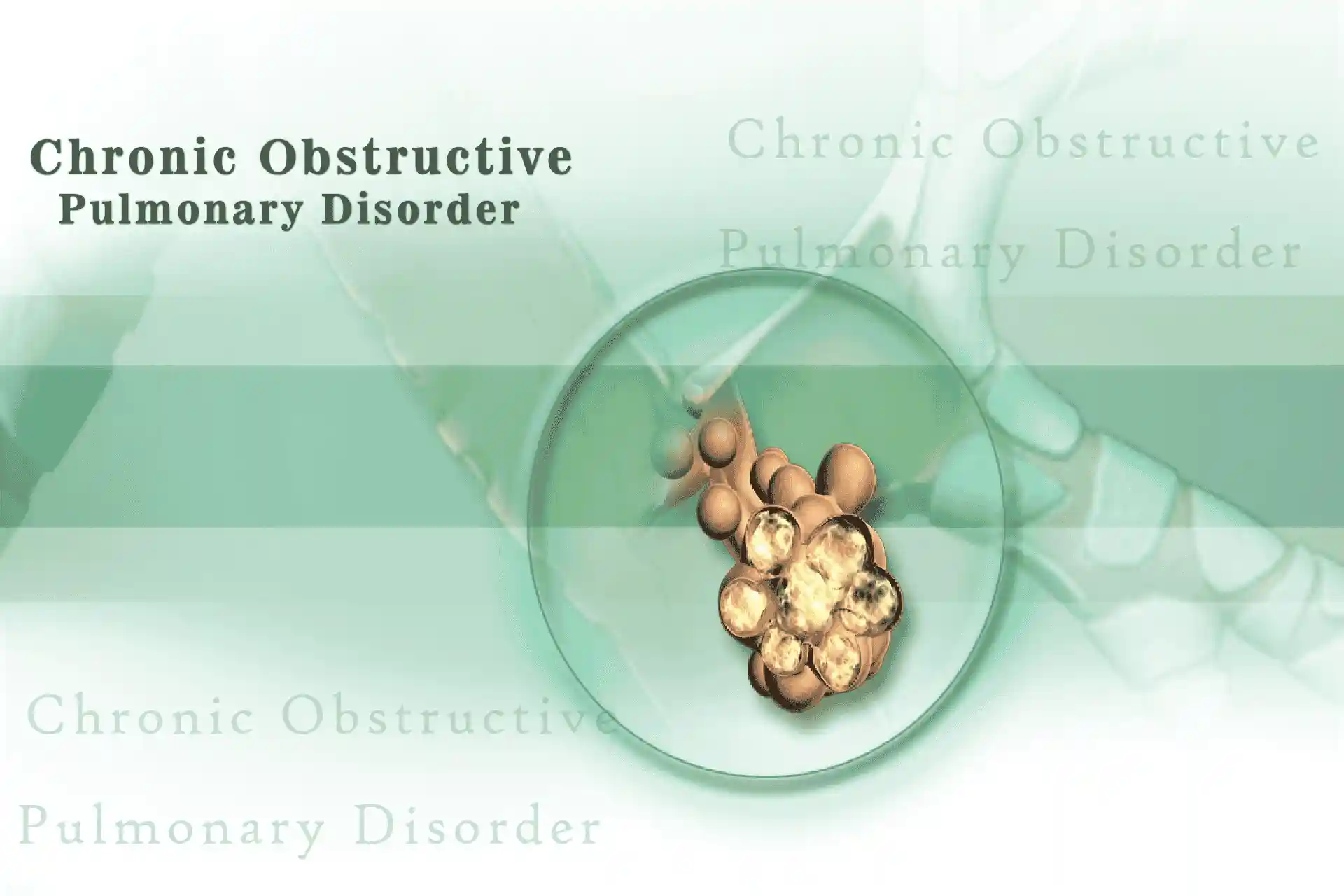 Chronic Obstructive Pulmonary Disease (COPD)